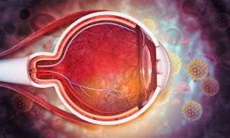 Wet AMD gene therapy